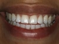 Konig Center for Cosmetic & Comprehensive Dentistry smile photos